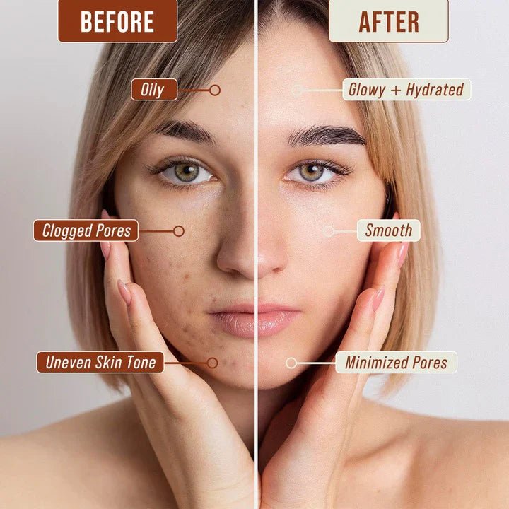 How Long Does Sandalwood Take to Work on Skin? A Science-Backed Guide - PRANA Beauty & Wellness