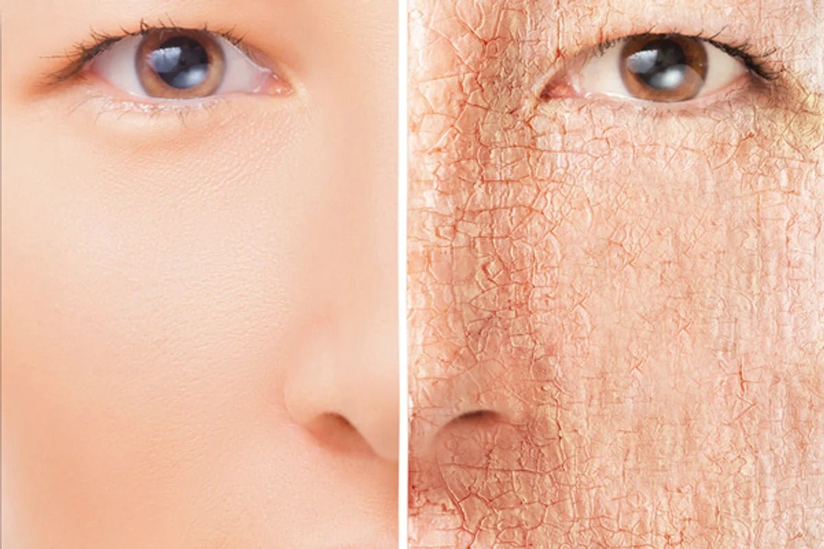 How to cure dry skin on face overnight? - PRANA Beauty & Wellness