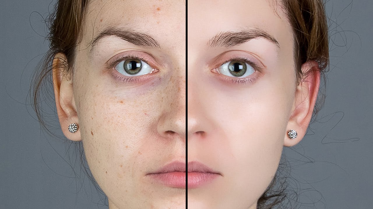 How to get fiberglass out of skin? - PRANA Beauty & Wellness