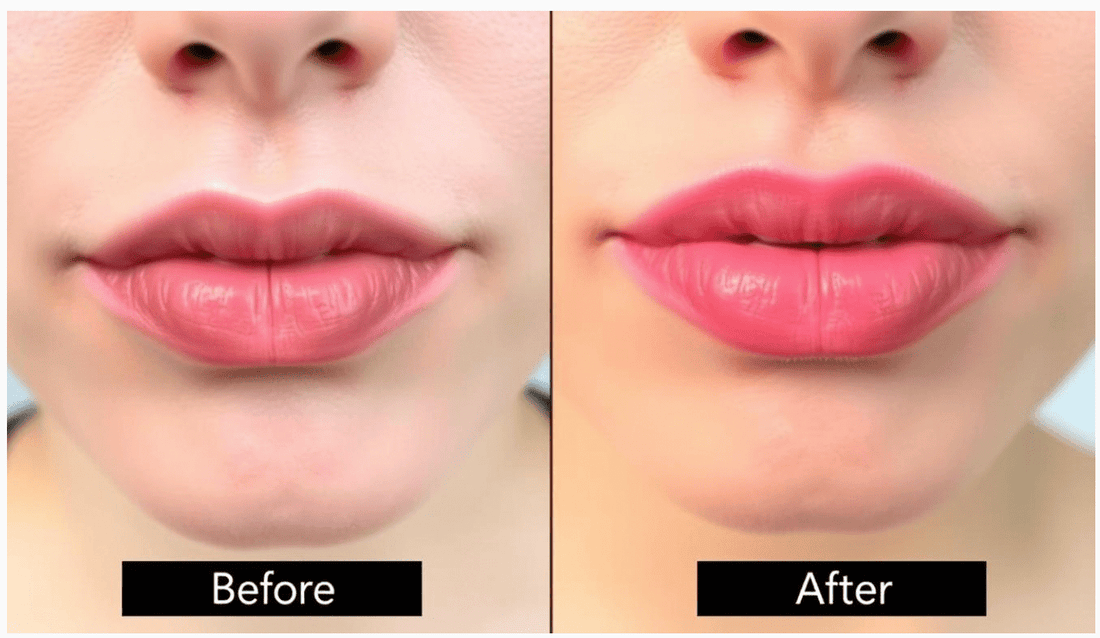 How to Get Pink Lips Naturally: Ayurvedic Remedies &amp; Care Tips - PRANA Beauty & Wellness
