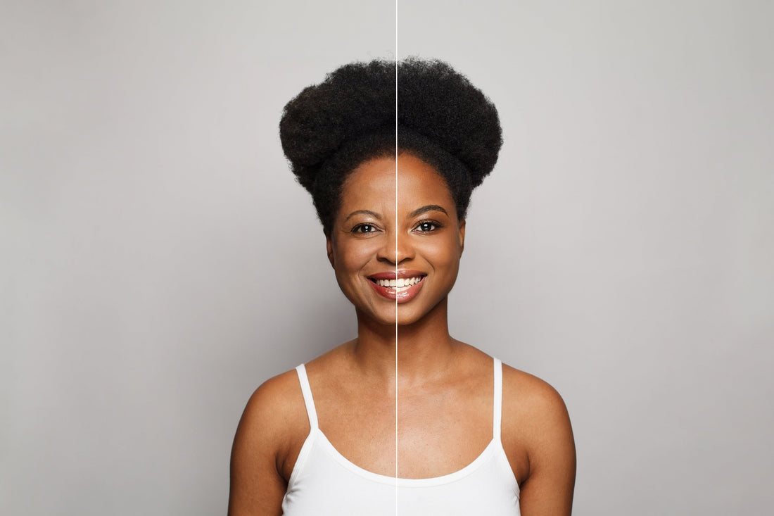 How to tighten skin? - PRANA Beauty & Wellness