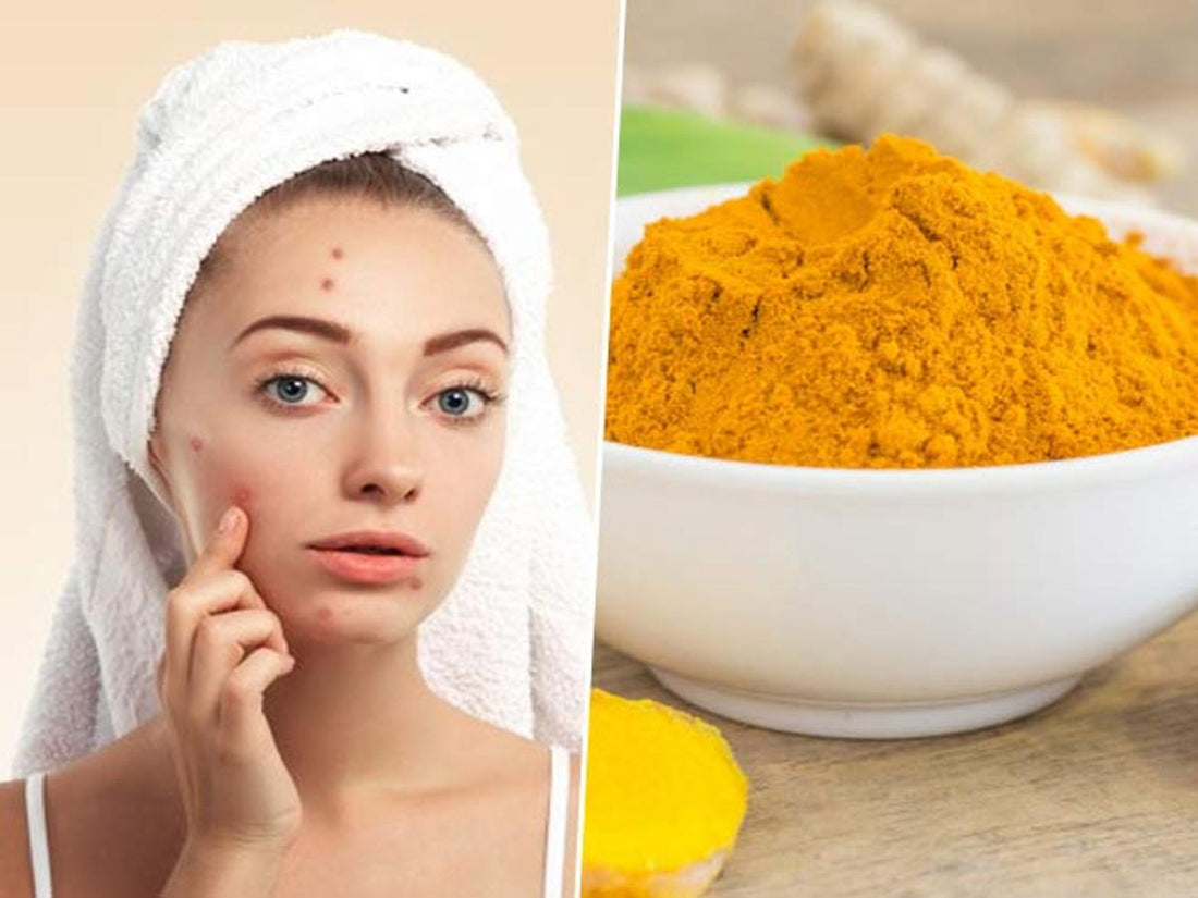What is turmeric face mask good for? - PRANA Beauty & Wellness