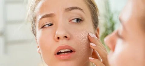 Why does my face never seem moisturized? - PRANA Beauty & Wellness